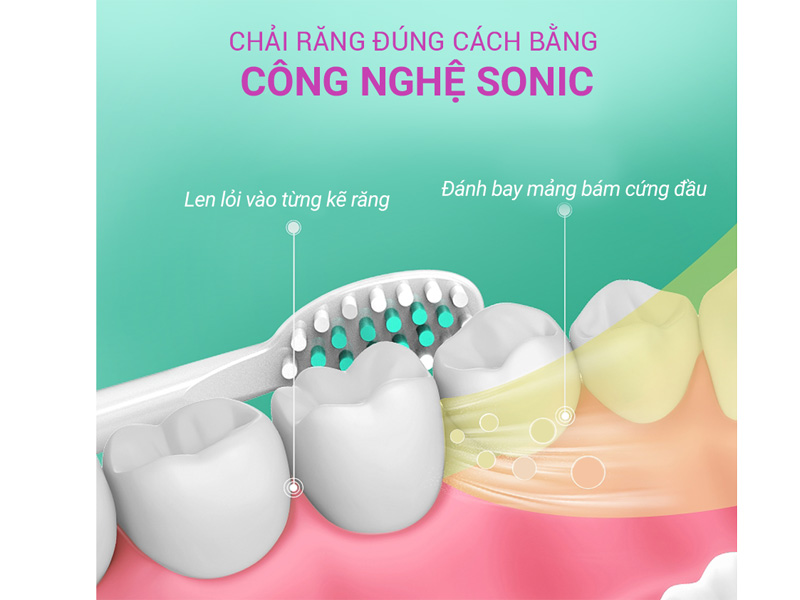 Bàn chải điện Sonic Life360 LE-BCD22A (Hồng)