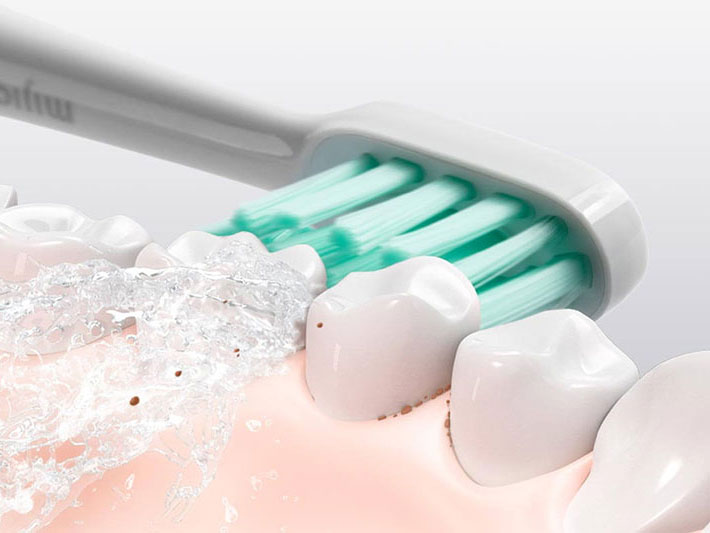 Bàn chải điện Xiaomi Mijia T500 MES601