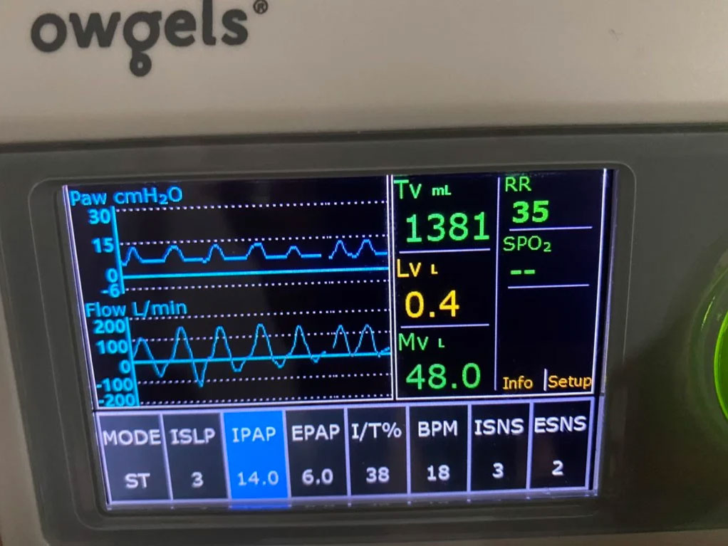 Máy trợ thở Owgels OGH-520C