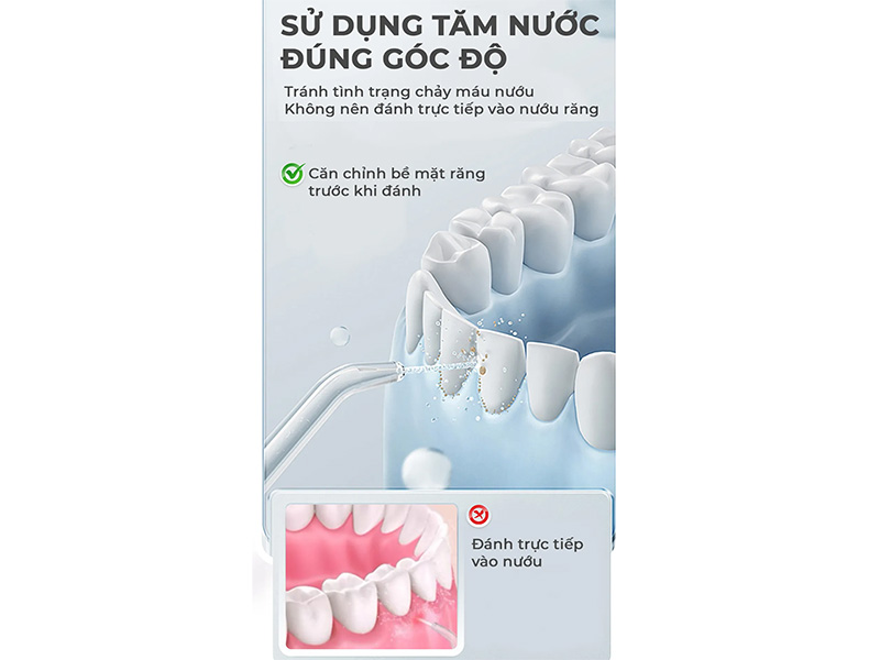 Máy tăm nước Magic Pro 80