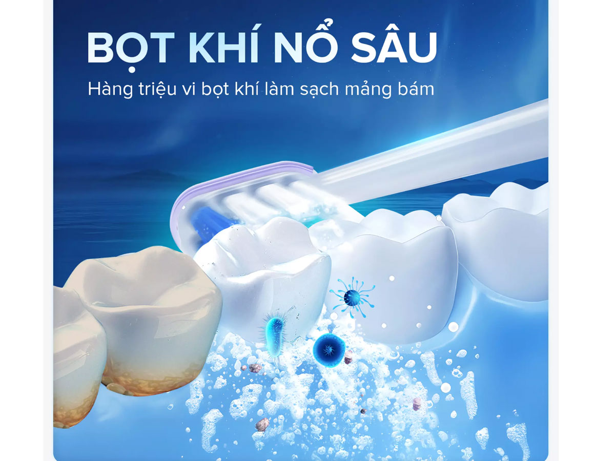 Bàn chải điện Maxcare Sonic X Whitening xoay 60 độ