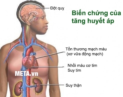 Máy đo huyết áp bắp tay Beurer BM44 giúp kiểm soát bệnh cao huyết áp hiệu quả.