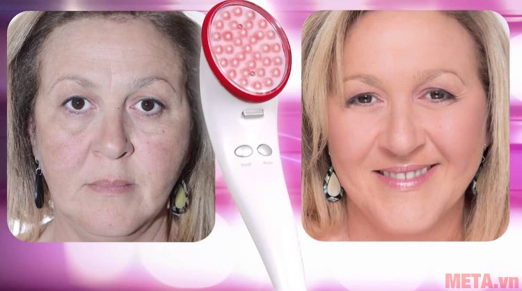 Máy massage mặt hồng ngoại Lanaform Beauty Light LA131307 cho hiệu quả sau 28 ngày sử dụng 