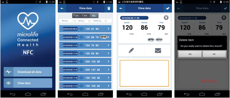 Với app microlife bạn có thể theo dõi các chỉ số sức khỏe trên điện thoại thông minh