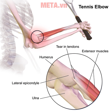 Đai hỗ trợ bảo vệ khớp và phục hồi chấn thương hiệu quả 