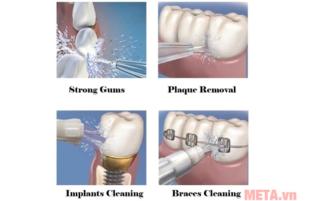 Waterpulse V400 Plus