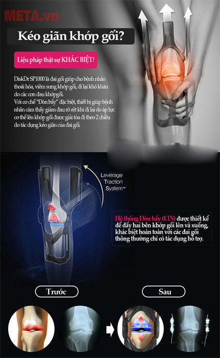 nguyên lý chữa bệnh Đai khớp gối