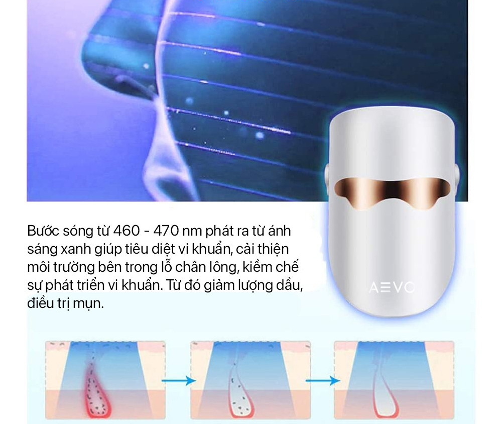Ánh sáng xanh giúp tiêu diệt mụn hiệu quả, cải thiện môi trường bên trong lỗ chân lông