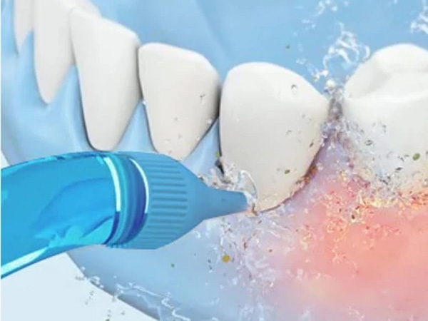 Loại bỏ mọi mảng bám trên răng, vi khuẩn có hại trong khoang miệng