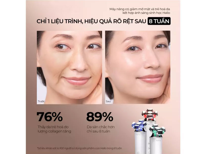 Máy nâng cơ, giảm mỡ mặt và trẻ hóa da Halio RevitaWave Skin Rejuvenator