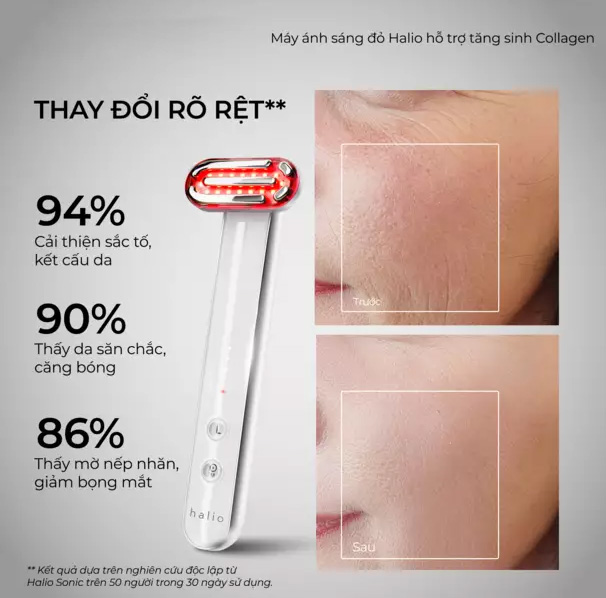 Máy ánh sáng đỏ tăng sinh collagen Halio