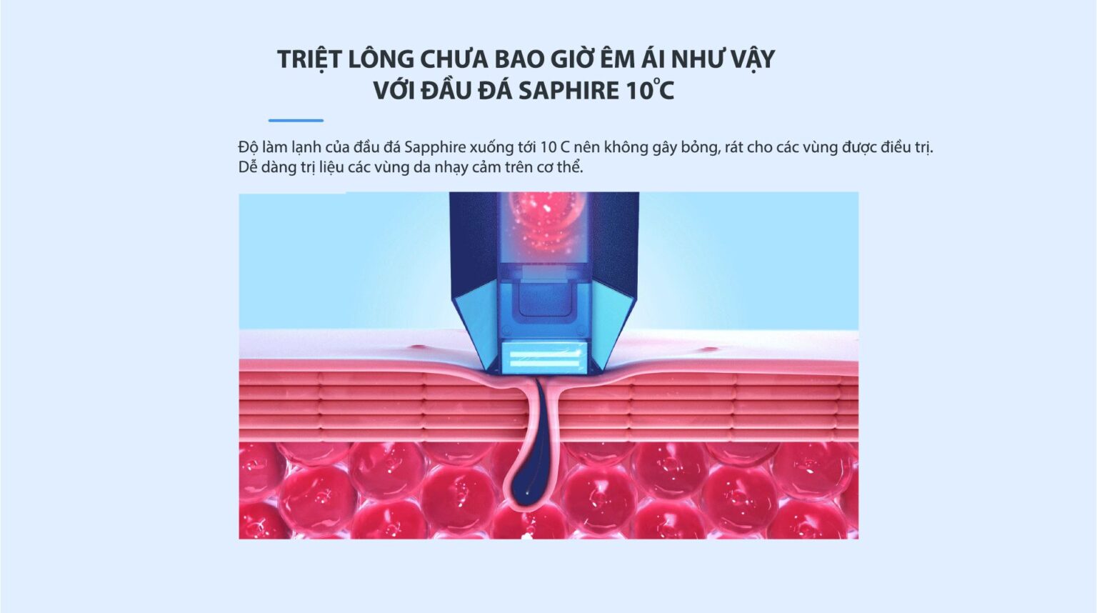 Máy triệt lông 